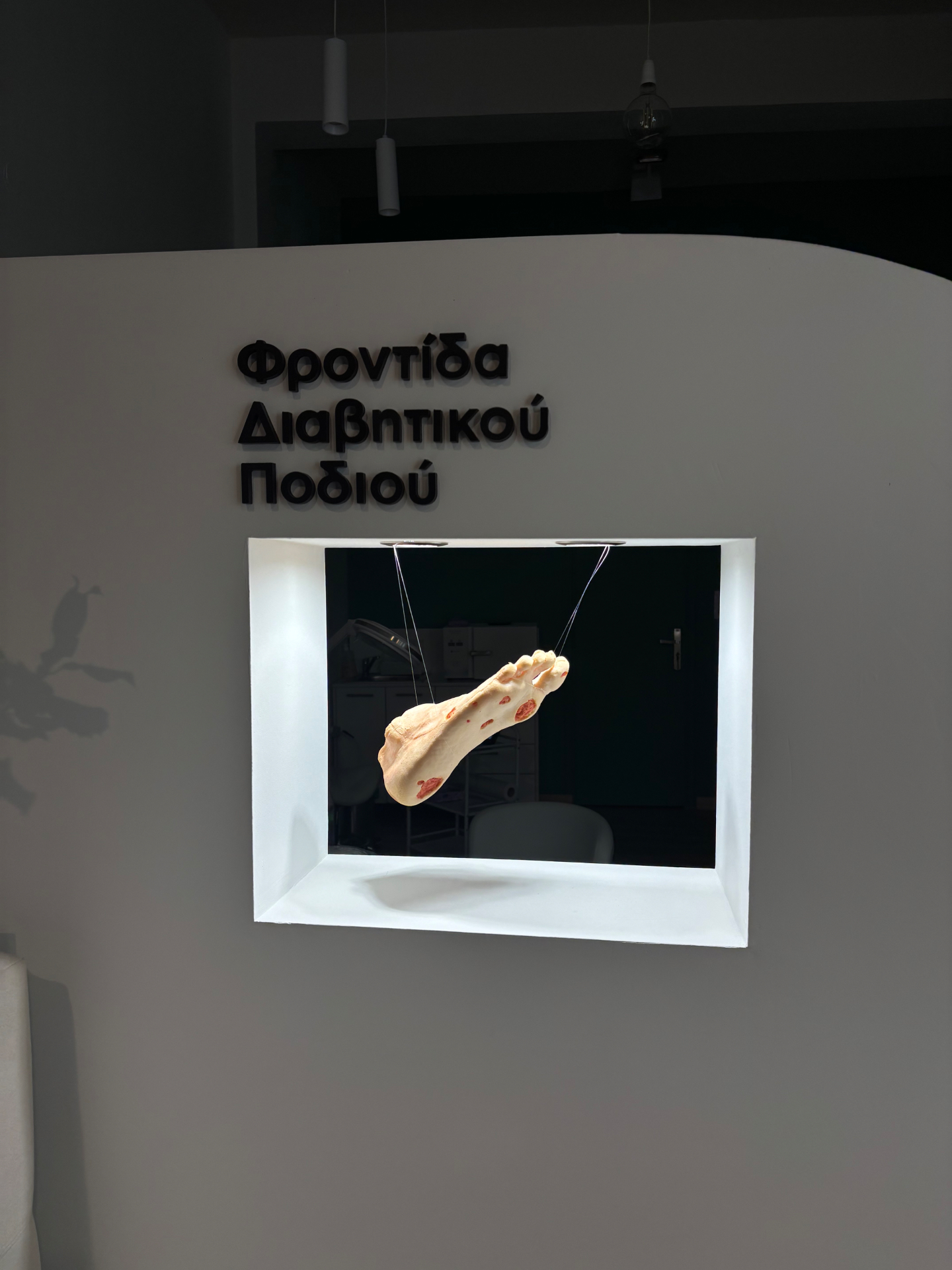 Φροντίδα διαβητικού ποδιού